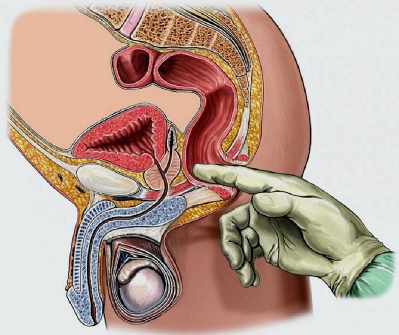 Prostate massage for prostate